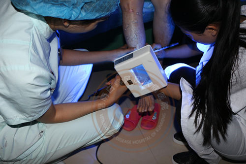 9月隐性白斑专项检测月 精准化智能定位白斑病灶