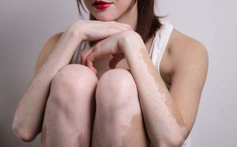 开学季:不做同学中的“斑长” 高效祛白颜值不打折