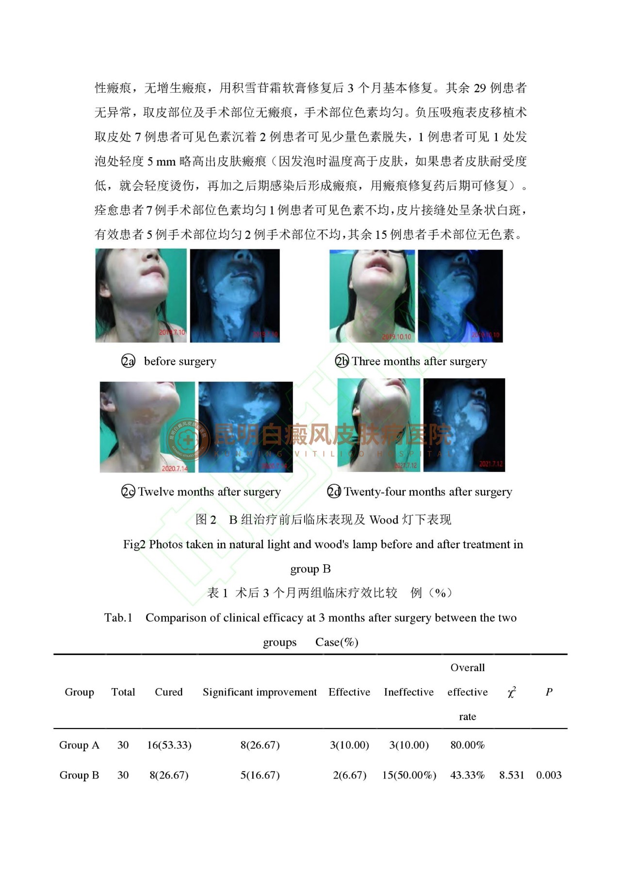 学术成果|昆明白癜风外科技术科研论文成功刊登《中国皮肤性病学杂志》